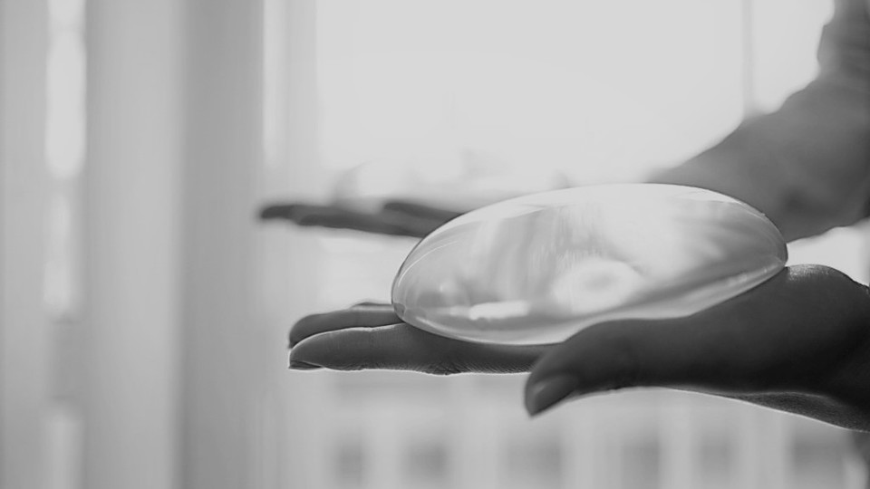 Allergan Biocell textured breast implants update